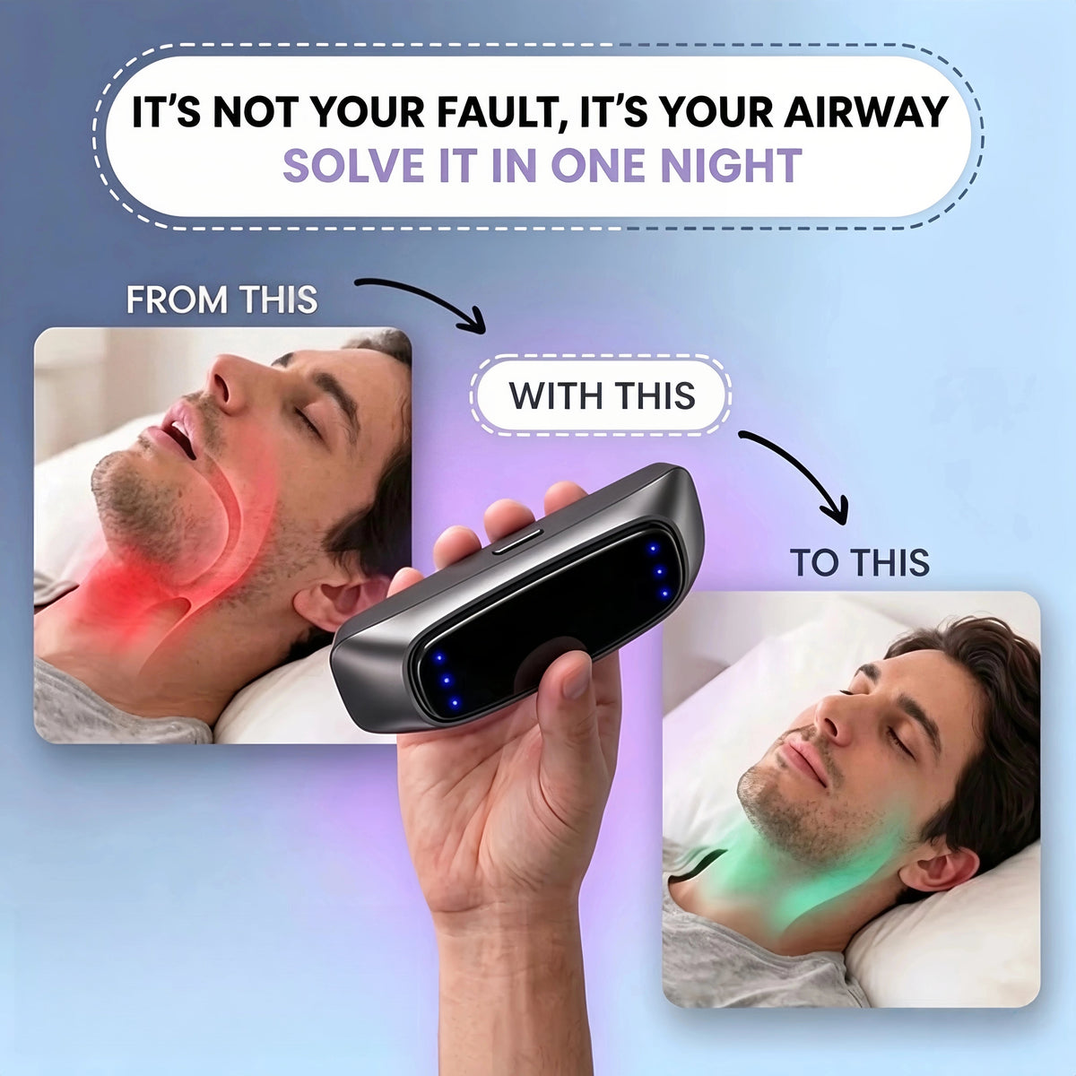 🌙 Anti-Snoring Device – Intelligent support for quieter nights